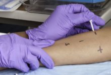 Anafilaksi (alerjik şok)