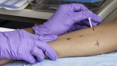 Anafilaksi (alerjik şok)