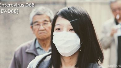 Enterovirüs D68 (EV-D68)