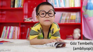 Göz Tembelliği (ambliyopi)