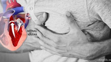 Mitral Yetmezliği