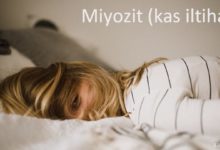 Miyozit (kas iltihabı)