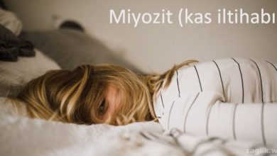 Miyozit (kas iltihabı)