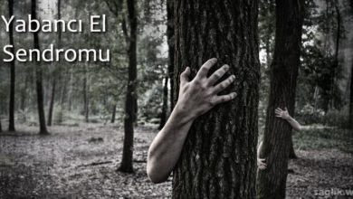 Yabancı El Sendromu