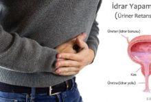 İdrar Yapamama (üriner retansiyon)