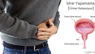 İdrar Yapamama (üriner retansiyon)