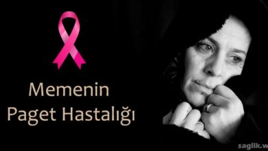 Memenin Paget Hastalığı