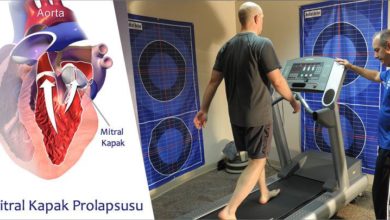 Mitral Kapak Prolapsusu