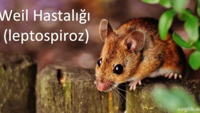 Weil Hastalığı (leptospiroz)