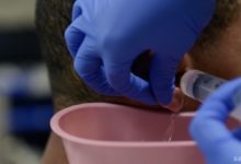 Sıkışmış Serumen (kulak kiri, buşon)