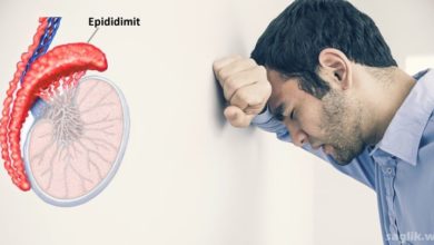 Epididimit Nedir
