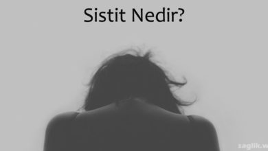 Sistit nedir?