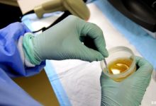 Hemorajik Sistit Nedir?