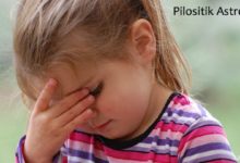 Pilositik Astrositom Nedir?