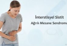 İnterstisyel Sistit Nedir?