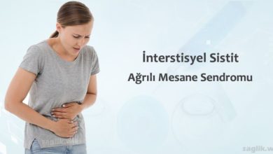 İnterstisyel Sistit Nedir?