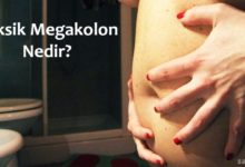 Toksik Megakolon