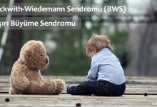 Beckwith Wiedemann Sendromu Nedir?