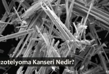 Mezotelyoma Kanseri Nedir?
