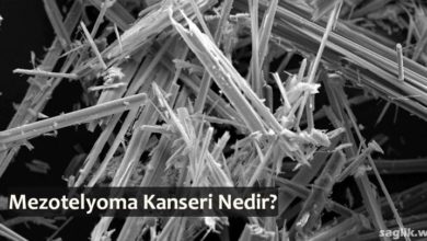 Mezotelyoma Kanseri Nedir?