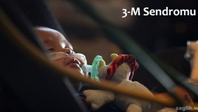 3M Sendromu