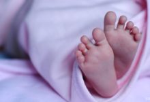 WAGR Sendromu / 11p Silme Sendromu