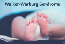 Walker-Warburg Sendromu