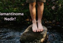 Adamantinoma Nedir?