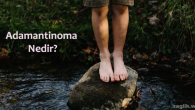 Adamantinoma Nedir?