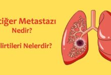 Akciğer Metastazı Nedir?