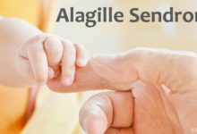 Alagille Sendromu