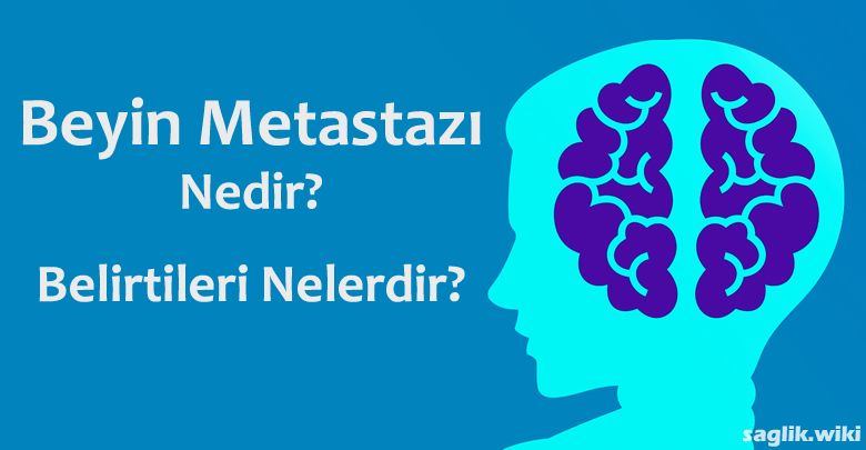 beyin metastazi nedir belirtileri nedenleri tedavisi