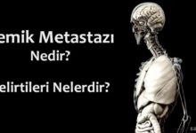 Kemik Metastazı Nedir?