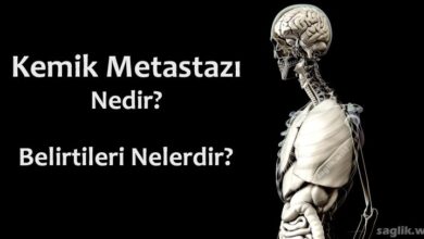 Kemik Metastazı Nedir?
