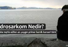 Kondrosarkom Nedir?