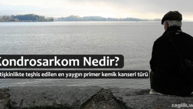 Kondrosarkom Nedir?