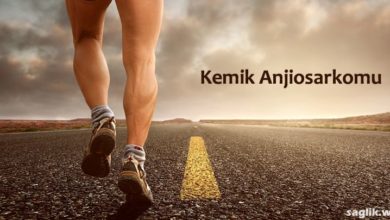 Kemik Anjiosarkomu Nedir?