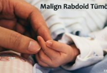 Malign Rabdoid Tümör