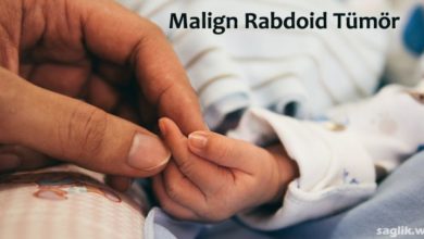 Malign Rabdoid Tümör