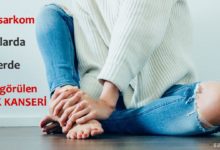 Osteosarkom Nedir?
