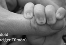 Rabdoid Karaciğer Tümörü