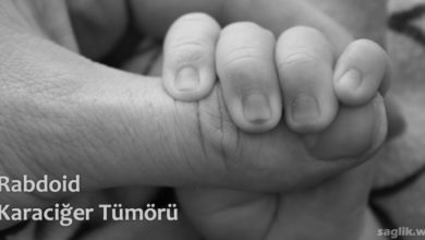 Rabdoid Karaciğer Tümörü