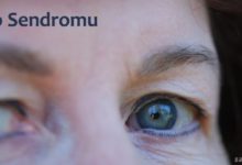 Yao Sendromu Nedir?