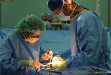 Apendektomi (Apandisit Ameliyatı) Nedir?