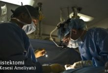 Kolesistektomi (Safra Kesesi Ameliyatı)