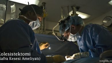 Kolesistektomi (Safra Kesesi Ameliyatı)