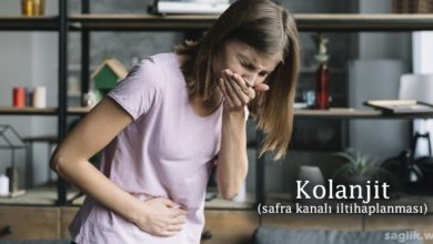 Kolanjit (Safra Kanalı İltihaplanması)