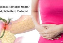 Safra Kesesi Hastalığı Nedir?