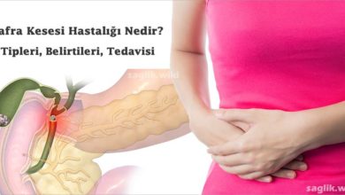 Safra Kesesi Hastalığı Nedir?