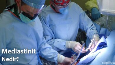 Mediastinit Nedir?